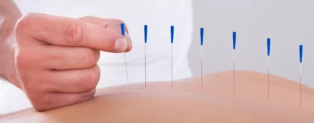 dry needling Overland Park and Olathe, KS